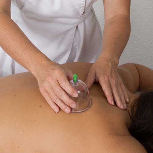 Cupping